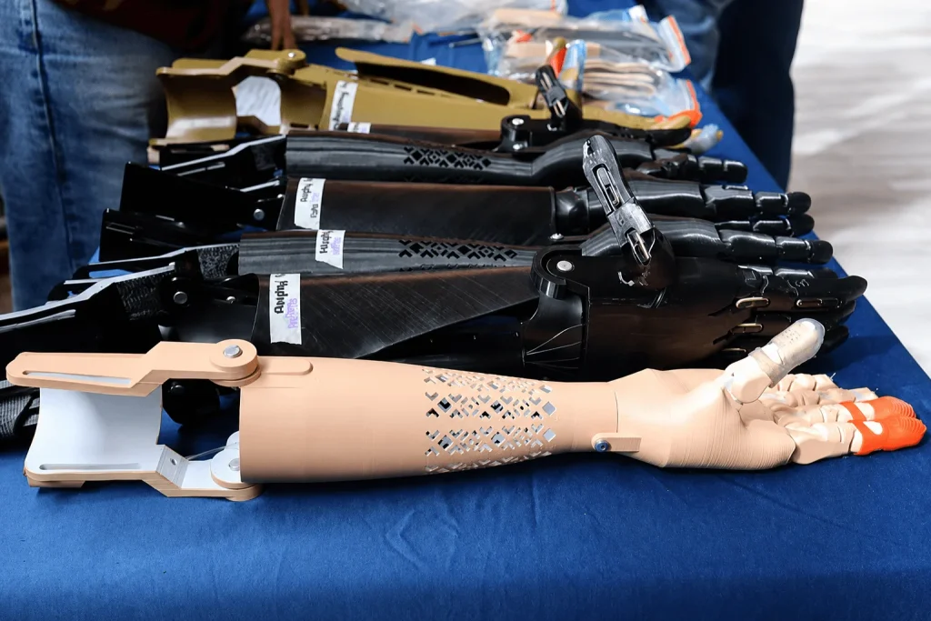 Prótesis impresas en 3D: de la tecnología a la vida cotidiana 3 Prótesis impresas en 3D de miembro superior utilizadas en procesos de rehabilitación y adaptación funcional.